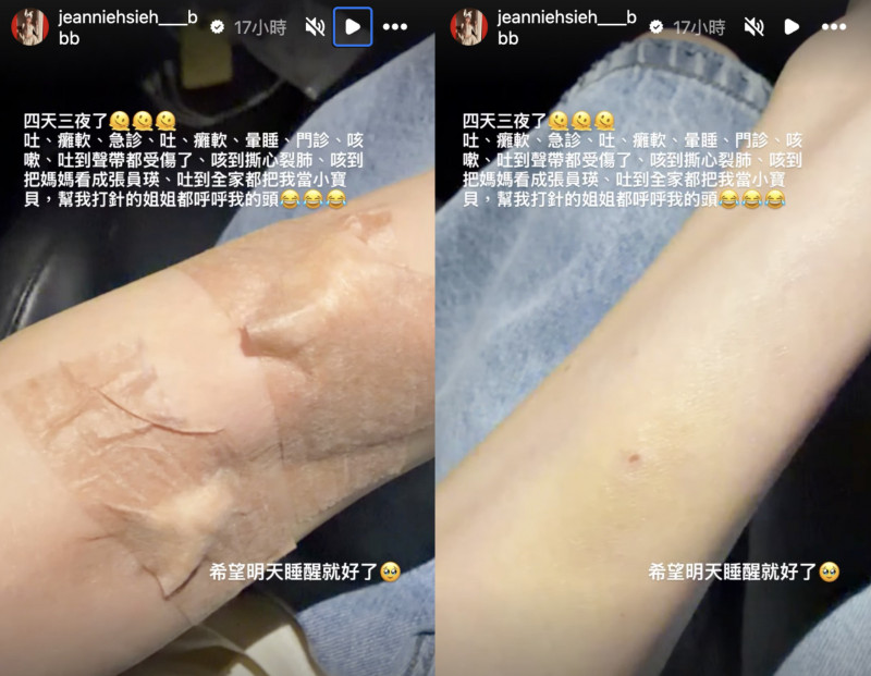 謝金燕公開近況，自曝頻繁嘔吐及咳嗽導致聲帶受傷。（翻攝自IG）