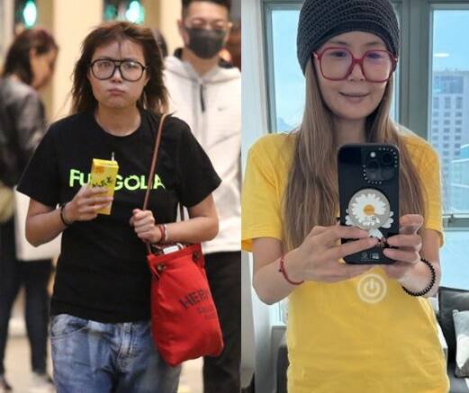 51歲世界級港女驚變紙片人 曾長期吃類固醇暴肥