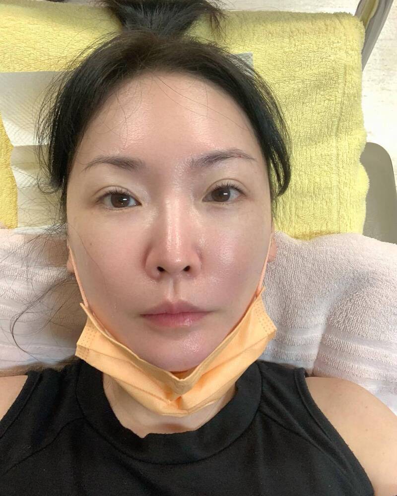 女星一覺醒來無法彎腰 急就醫冒出一堆病