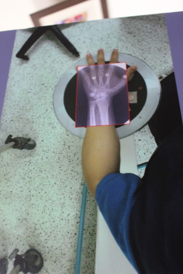 全台首支醫療頭戴式智慧眼鏡 「眼見為憑」手術更精準