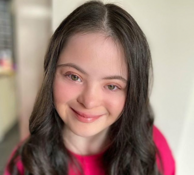 健康網》染色體不是限制 倫敦唐氏症女孩當模特登上Vogue雜誌