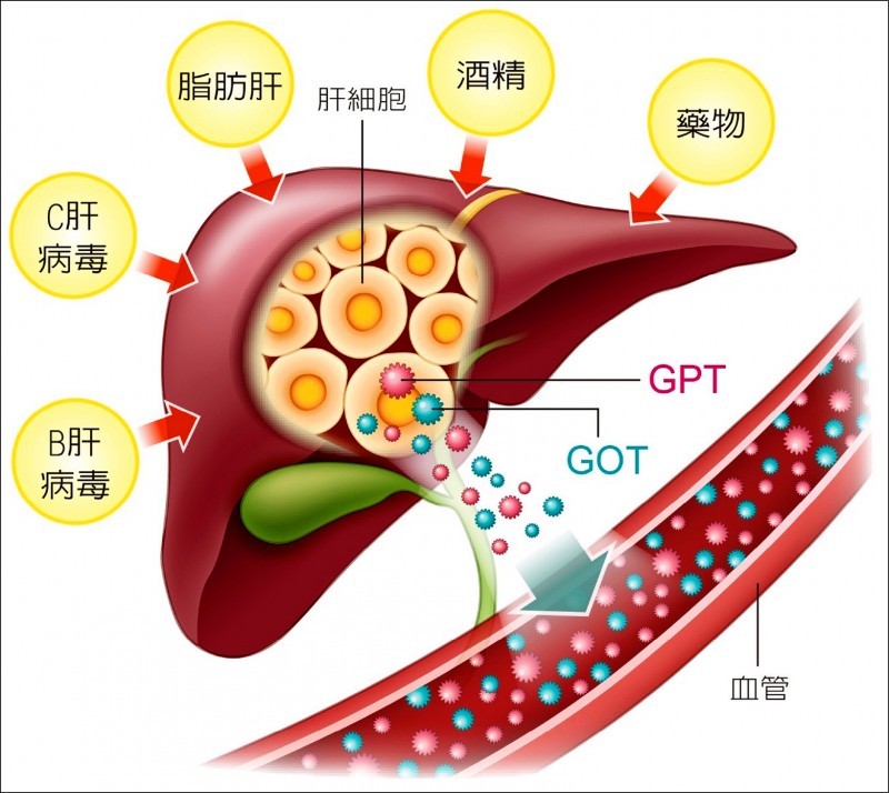 《愛肝加油站》控制酒精性肝病 戒酒、減脂一起來
