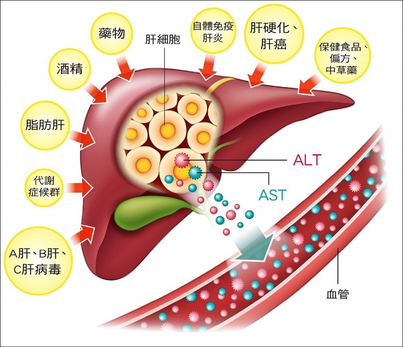 愛肝加油站》減重後脂肪肝緩解 肝指數也會跟著下降