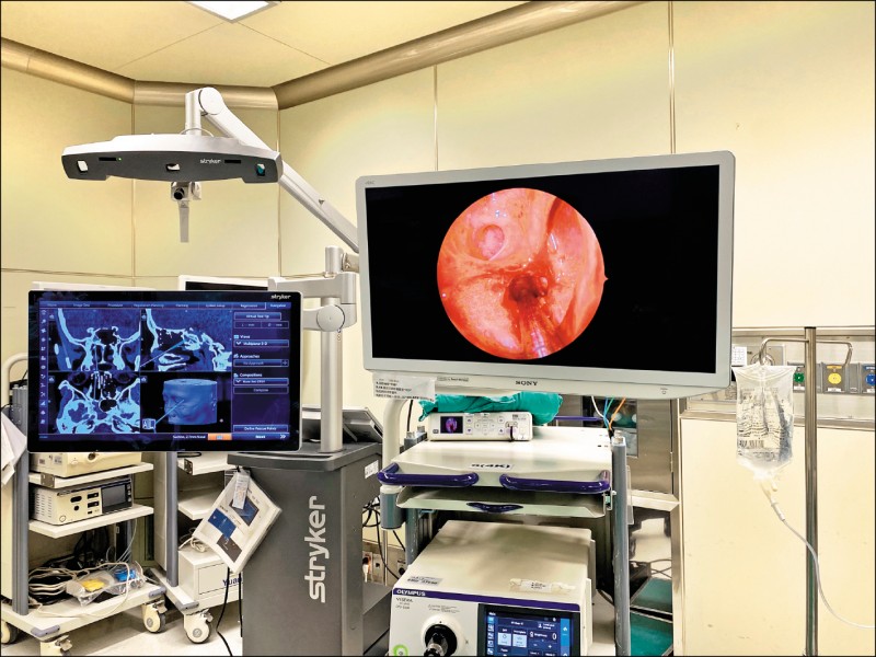 復發性鼻竇炎 4K式3D導航定位精準清病灶