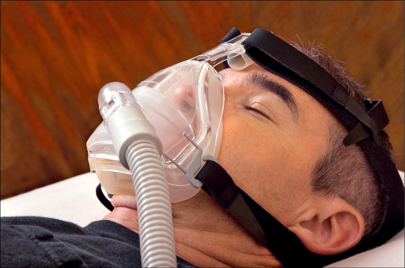 重度睡眠呼吸中止 舌根部縮減改善缺氧