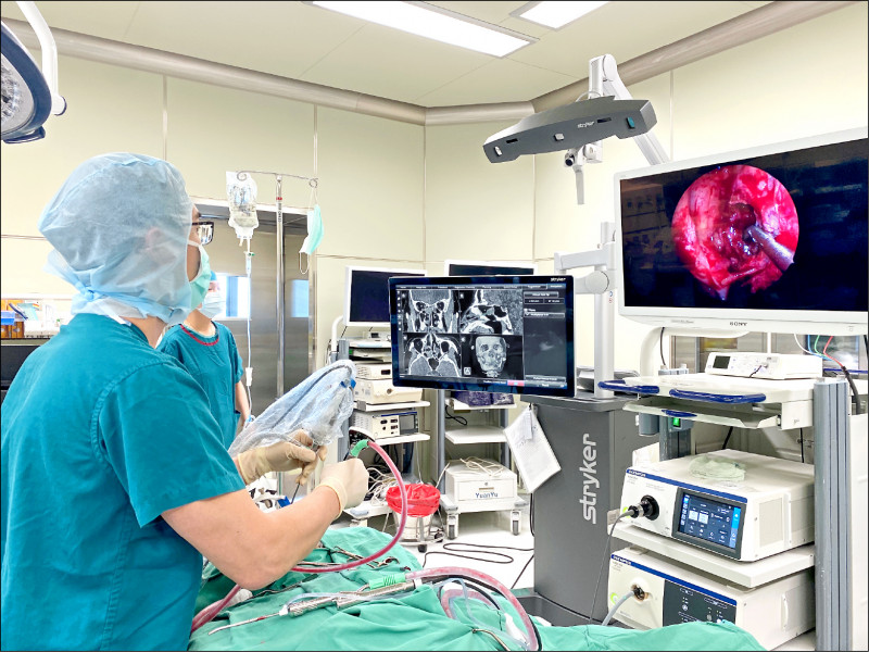 老是聞到魚腥味又鼻塞？ 竟是鼻竇長黴菌