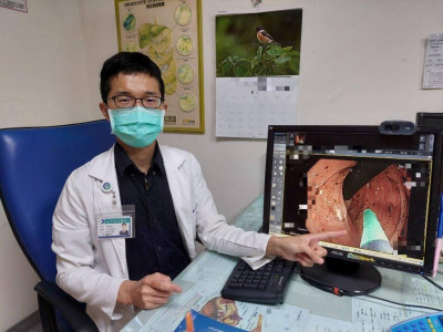 8旬老婦大腸多處急性出血 氬氣電燒助止血