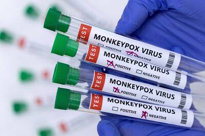健康網》猴痘入境心慌慌？ 關於猴痘該知道的10件事
