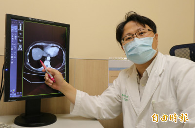 B肝帶原者檢查做半套 就醫竟確診肝癌第2期