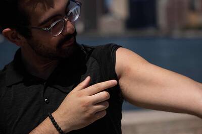 健康網》任何人都可能染上猴痘 義研究：可由性傳播感染