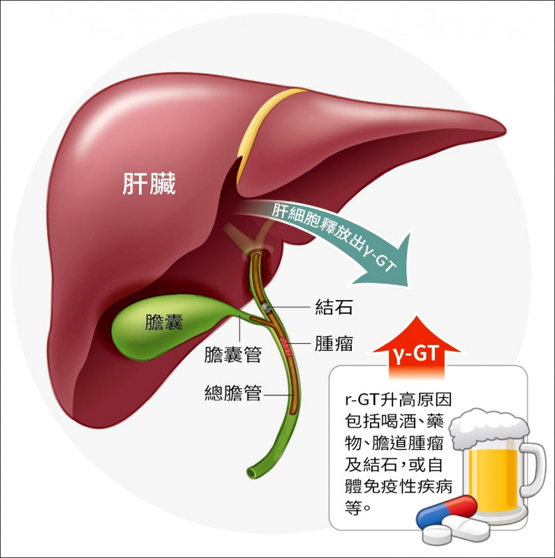 《愛肝加油站》喝酒、吃藥、膽結石 都會導致r-GT升高