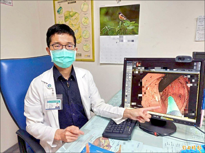 87歲嬤大腸多處出血 「氬氣電燒」助止血