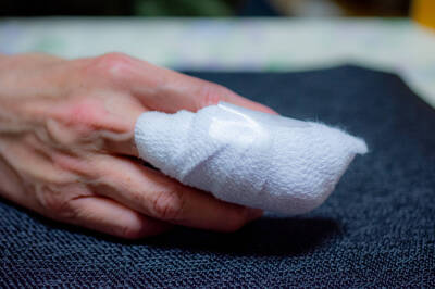 健康網》手指頭吃蘿蔔乾！ 治療師：「5」步急性自救法