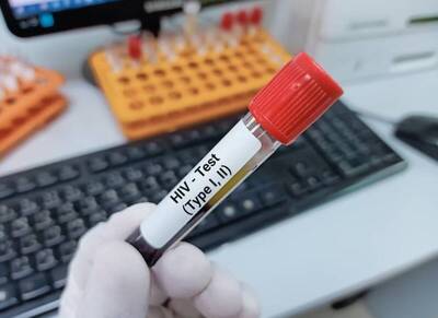 健康網》測不出HIV仍會傳染！ 醫：U=U才可忽略傳播風險