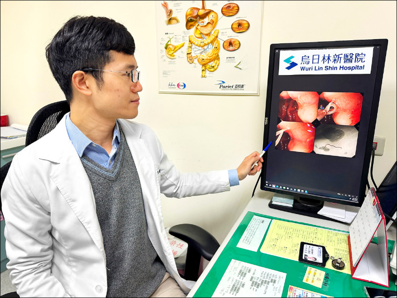 狂吃生魚片解黑便 賁門夾出海獸胃線蟲