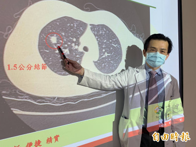 久咳不癒以為長新冠 一查竟是肺癌