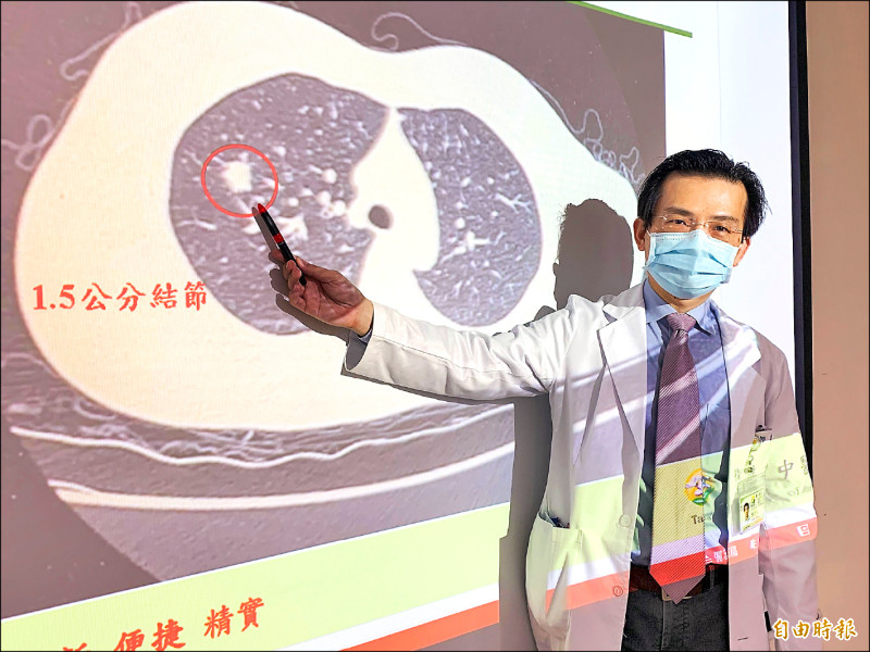 不是長新冠》 確診後久咳不癒 一查竟是肺癌1期