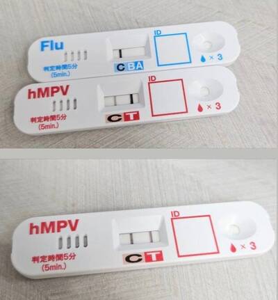 健康網》病毒好多！ 醫示警：高燒數日、劇烈咳嗽恐hMPV作祟