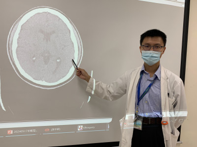 36歲男腦中風！上班時突臉歪嘴斜 緊急打血栓溶解劑