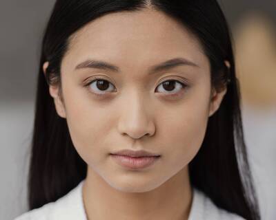 健康網》不想頂著熊貓眼？  3種消滅黑眼圈手術一次看