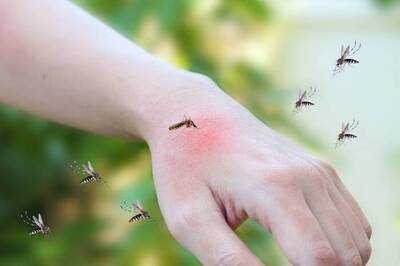 健康網》蚊蟲叮咬怎麼止癢？ 醫教1招秒緩解