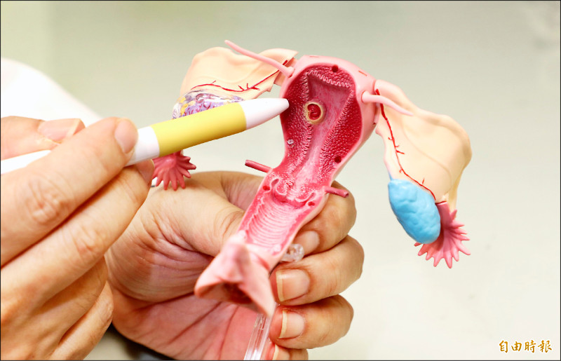 22週胎兒胎死腹中 原來是「抗磷脂症候群」