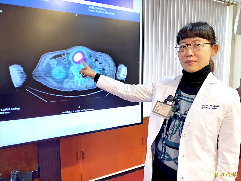核醫新療法 精準治療賈伯斯病