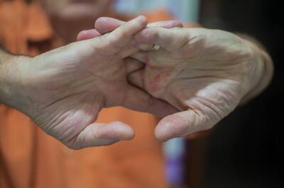 健康網》啵一聲折手指會關節炎？ 醫「50年親測」揭密了