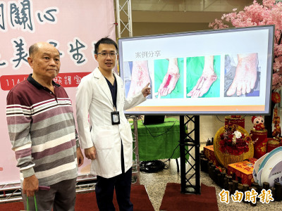 高齡糖友左腳小傷口發炎腫如麵龜 創新傷口治療保左腳