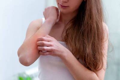 健康網》告別皮癢！ 營養師：抗敏食物「9要3不」這樣吃