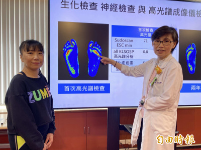嗜甜舞蹈老師 減重逆轉糖尿病！醫：小心周邊神經病變