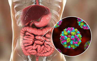 健康網》諾羅害上吐下瀉！ 醫：如廁用「1物」恐成病毒溫床