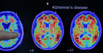 站起來救大腦！   研究：久坐恐增失智風險  運動也難抵銷