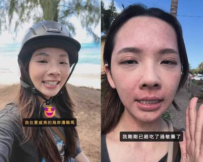 健康網》滴妹騎馬後竟嚴重過敏 醫談常見過敏原