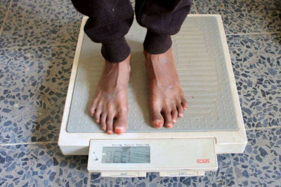 逆轉糖尿病前期 別只減重！研究：運動、飲食有幫助