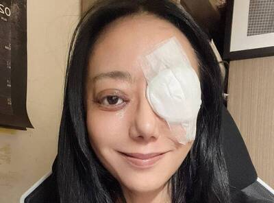 健康網》高慧君險失明！甲狀腺異常引斜視 醫：身心幻覺是警訊