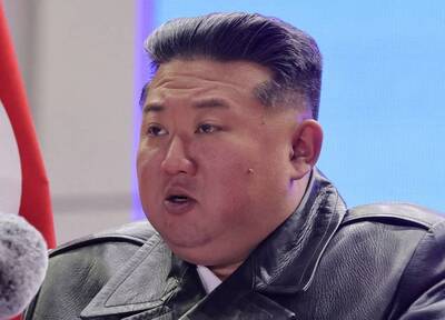 健康網》金正恩臉上冒肉芽 醫：4原因會長出來