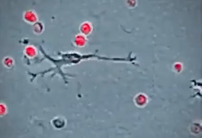 研究巨噬細胞促進發炎 阻斷關鍵蛋白可防發炎加劇