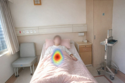 亞東醫院鎦-177-PSMA治療 助攝護腺癌患者