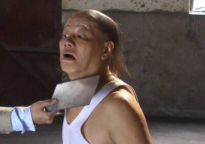 健康網》《功夫》梁小龍曾遭襲中3刀 醫：外傷後3大警訊