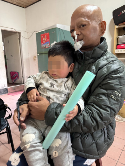 口腔癌父切臉求生為守護兒 陽光籲送暖守護顏損家庭