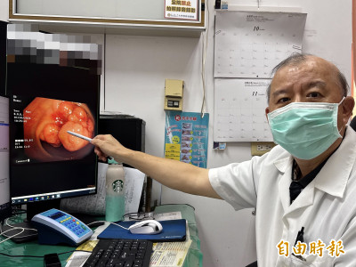 瘦10公斤別高興太早！6旬婦以為減肥成功 醫：腫瘤塞滿腸道