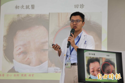 皮蛇爬上眼！8旬嬤右眼睜不開  險失明住院1週
