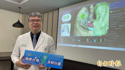 65歲男0.9公分肺結節  AI輔助3D影像重組助精準切肺