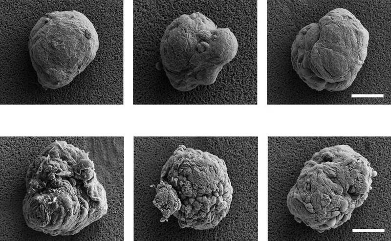 糖尿病細胞移植不用抗排斥藥？「隱形斗篷」讓血糖穩逾百天