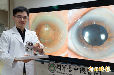 8旬翁視力只剩0.05  靠這健保白內障手術重見光明