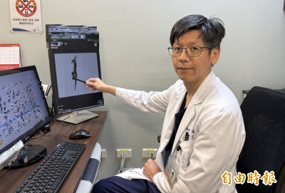 6旬婦「浮腳筋」忍30年突腫痛！  醫提醒：血栓風險高5.3倍