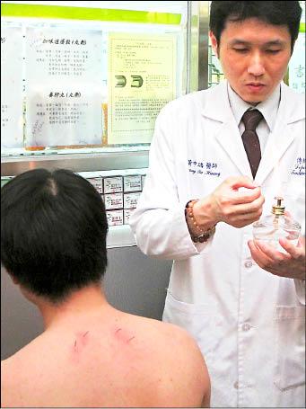 火針療法 緩解肩頸痠痛 - 自由健康網