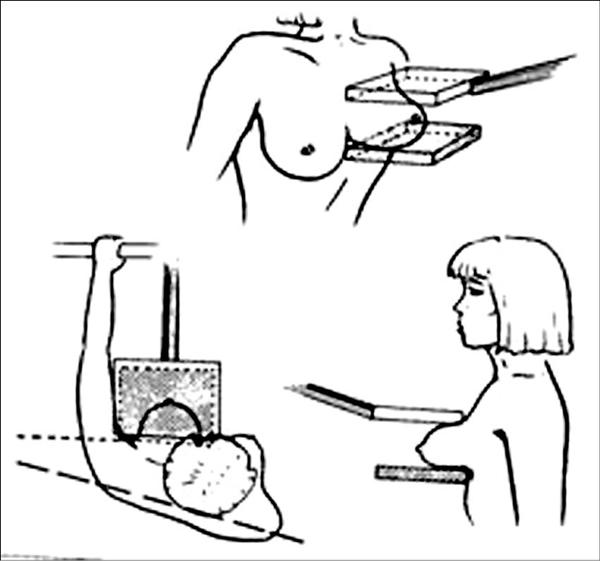 熟女乳癌篩檢 45歲起免費哦！