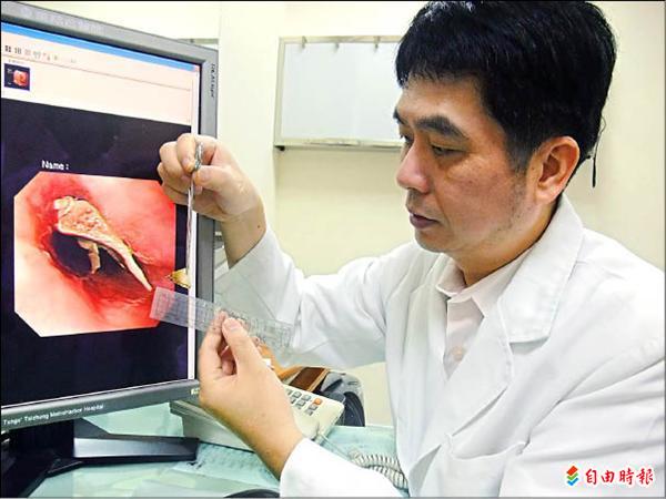 誤吞雞骨 喉嚨痛啊